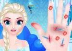 醫生 對於艾爾莎Frozen的手