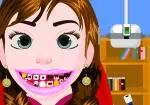 Anna - La Reine des neiges - Les soins dentaires